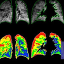 Polarean Imaging plc